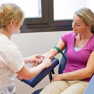 Нормата на тестването на жената. Общият или общ анализ на кръвта: норма или честота при жените