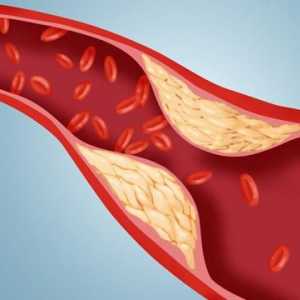 Нормата на холестерола в кръвта на мъжете. Индикатори на холестерола в кръвта