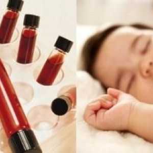 Норми за кръвни тестове при деца. Декодиране и характеристики на събирането