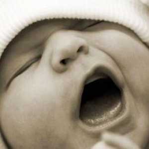 CNG на мозъка на новородените: декодиране, норми