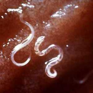 Дали е необходима профилактика на червеи при възрастни. Лекарства от червеи: таблетки и тинктури