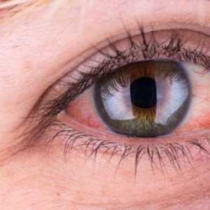 Ocalin в окото - какво да правя? Първа помощ за очни травми