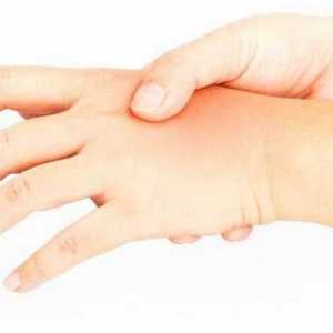 Измама на пръстите на лявата ръка: причини и лечение