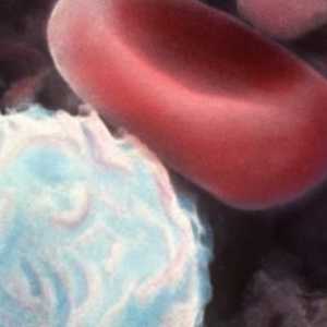 Опасно ли е, когато лимфоцитите се отглеждат при деца?