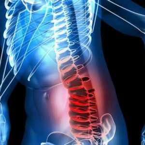 Операции на гръбначния стълб и рехабилитация
