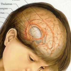 Мозъчен тумор: симптоми на ранен етап. Първите признаци на мозъчен тумор
