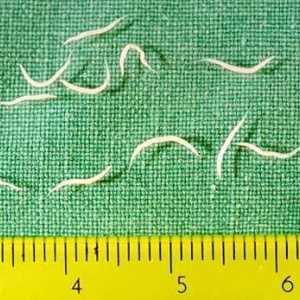 Pinworms при деца: симптоми. Таблетки от червеи за деца. Дете има червеи - какво да правим?