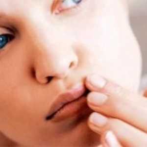 От това, което се появява херпесът на устните: причините, профилактиката, лечебните функции