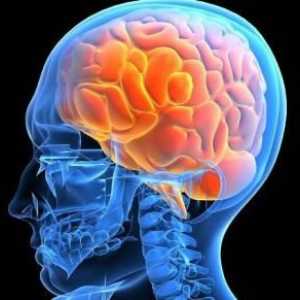 Оток на мозъка: причини и последици. Церебрален оток при деца и възрастни