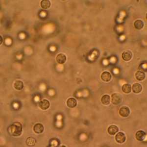 Патогенни бактерии в урината, какво означава това?