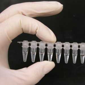 PCR-диагнозата на инфекциите и обхвата на тяхното използване
