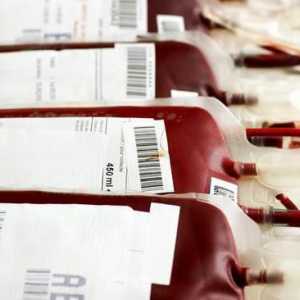 Кръвопреливане по кръвни групи: правила. Универсални донори. Таблица на съвместимостта на кръвните…