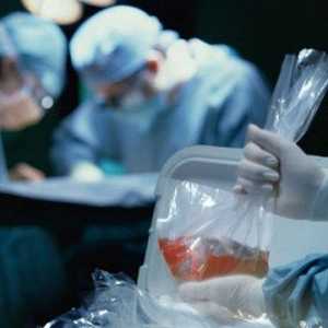Трансплантация на бъбреци: операция, в която се извършва, живот след интервенция, опашка