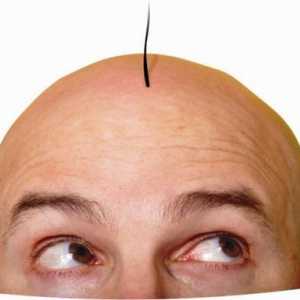 Трансплантация на коса: мнения, цени, снимки