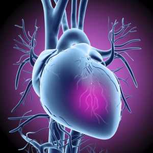Първите симптоми на сърдечен удар при жените и мъжете