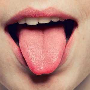 Защо се е припокрил езикът: причини, симптоми на болести, лечение