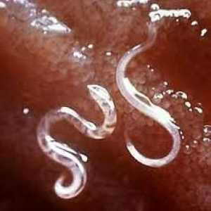 Защо се появяват червеите в детето? Лечение на заболяването