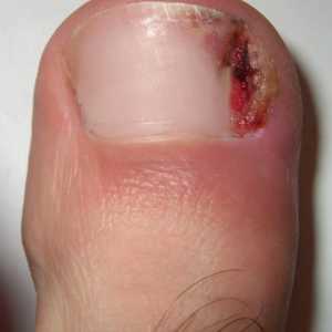 Защо нокътът расте на големия пръст?