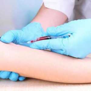 Подготовка за биохимичен кръвен тест: правила и съвети