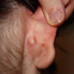 Подвижни удари зад ушите - какво е това?