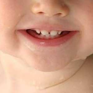 Редът и схемата на зъбите в детето