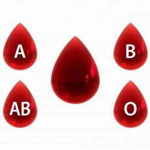 Правила за определяне на кръвната група според системата ABO
