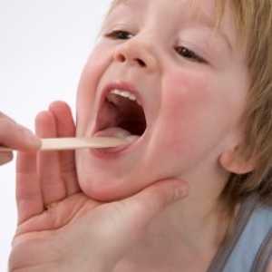 Правилно лечение на аденоидит при деца