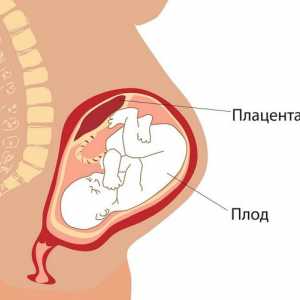 Преждевременно узряване на плацентата: причини, симптоми и признаци на лечение