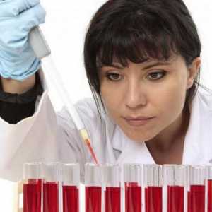 Причини за увеличаване на ESR в кръвта при жени, диагноза, лечение