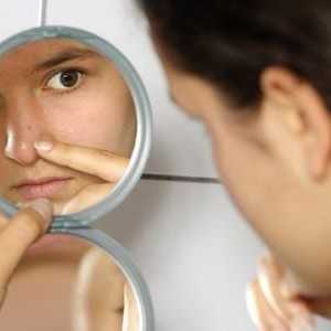 Причините за себорея на лицето