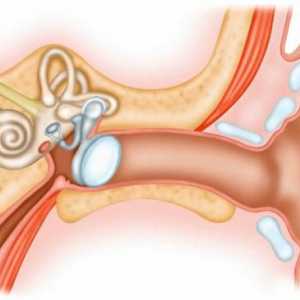 Корк в ухото: симптоми, начини на отстраняване