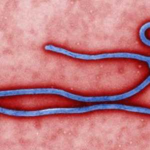 Предотвратяване на треска Ебола. Ебола треска: симптоми, лечение