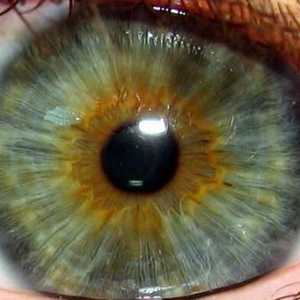 Ирис на окото: цвят, петна, болести