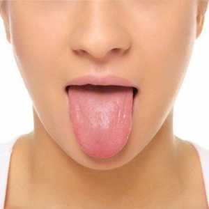 Рак на езика: признаци и симптоми. Консултация с онколозите