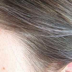 Ранна сива коса: причини и лечение при жени и мъже