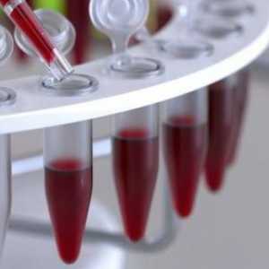 Декодиране на кръвния тест за НСТ, норма