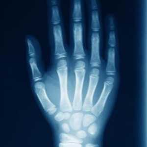 Ръчни рентгенови лъчи за заболявания и наранявания