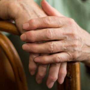 Ревматоиден артрит на пръстите: първите симптоми, причините и лечението