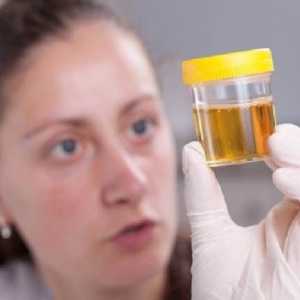 Каква е причината за мътната урина при децата?
