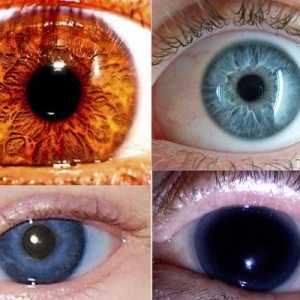 Най-редкият цвят на очите - какво е това?