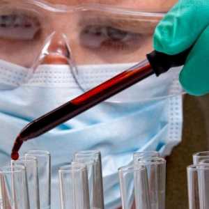 Серологични тестове на кръвта при диагностициране на заболявания