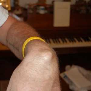 Конуси на ръка върху китката или хигром: симптоми, причини и методи на лечение