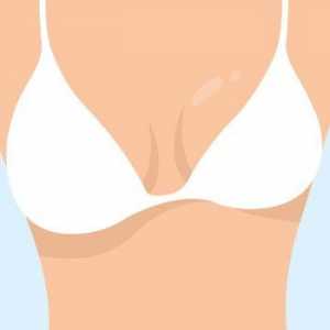 Силна асиметрия на гърдата: възможни причини, симптоми, диагноза и терапевтични характеристики