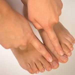 Симптомите на гъбичките на ноктите по краката, характеристиките и сортовете