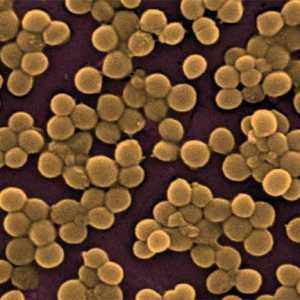 Staphylococcus върху кожата: симптоми и лечение