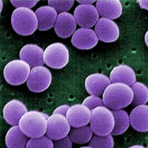 Staphylococcus при деца: снимки, симптоми и лечение