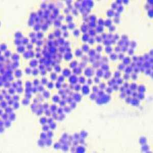 Staphylococcus a дете: симптоми и лечение