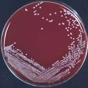 Staphylococcus epidermidis (стафилококов епидермис) - симптоми, причини, лечение. Каква е нормата в…