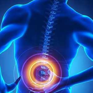 Стеноза на лумбалната част на гръбначния стълб: причини и лечение