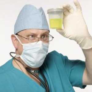 Ежедневна диуреза или как да събирате ежедневно урината